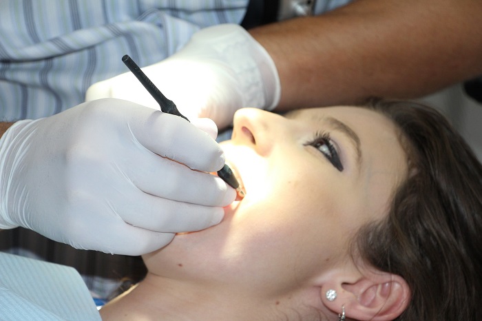 لمینت دندان در ترکیه