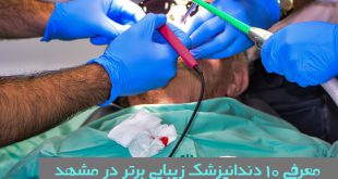 بهترین دندانپزشک زیبایی در مشهد
