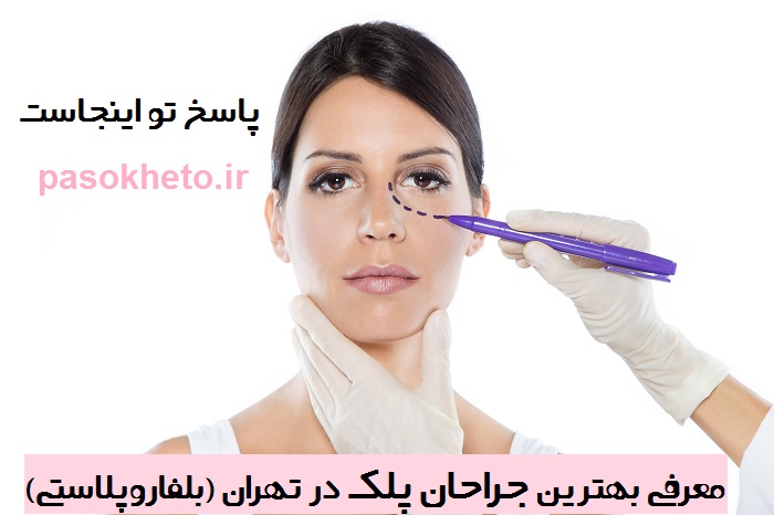 بهترین جراح پلک در تهران