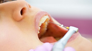 متخصص ریشه دندان در کرج