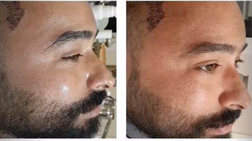 پاکسازی صورت مردانه