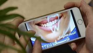 دندانپزشک خوب در پونک تهران